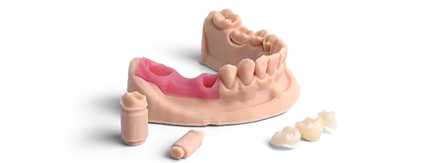 Dental arch model printed in Phrozen Gingiva Mask resin, showing pink gum tissue with implant posts and crowns