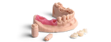Dental arch model printed in Phrozen Gingiva Mask resin, showing pink gum tissue with implant posts and crowns