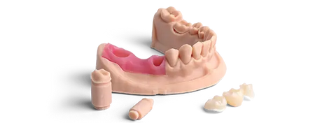 Dental arch model printed in Phrozen Gingiva Mask resin, showing pink gum tissue with implant posts and crowns